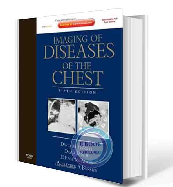 دانلود کتاب  Imaging of Diseases of the Chest  ( PDF)